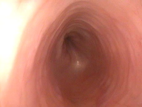 L'esofago di un gatto visto attraverso l'endoscopio durante una gastroscopia
