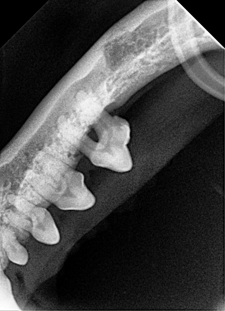 Radiografia dentale endorale: depositi di tartaro sulle corone e osso sofferente attorno alle radici